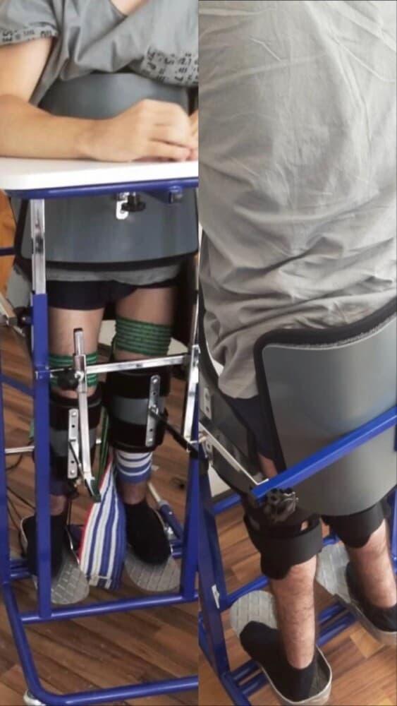Pacient gjatë rehabilitimit neurologjik, duke qëndruar në pozicion vertikal me mbështetje